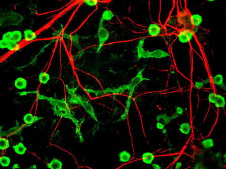 reversing-aging/microglia.png